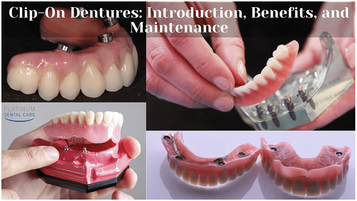 Clip-On Dentures: Introduction, Benefits, and Maintenance